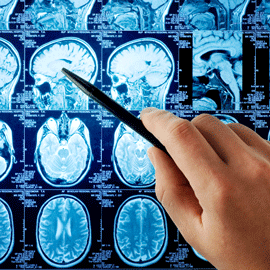 Dallas MRI Contrast Lawsuits